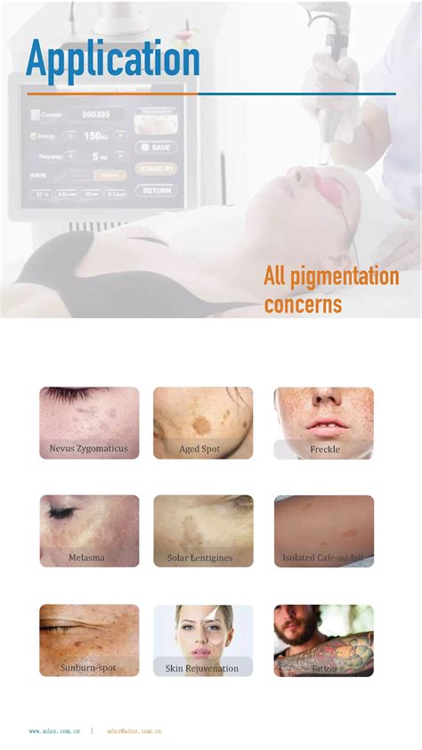 Picosecond Laser Machine | Picosecond Laser Removal Tattoo Machine