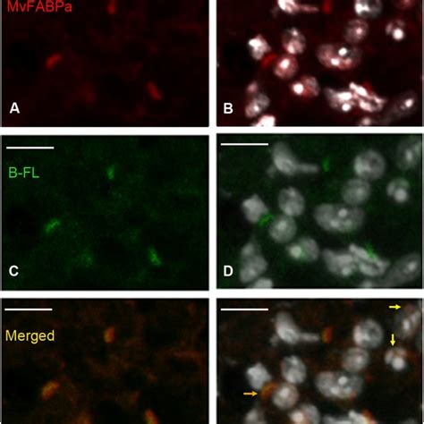 Tetrathyridia In Vivo Uptake Of A Fatty Acid Analogue Bodipy Fl C