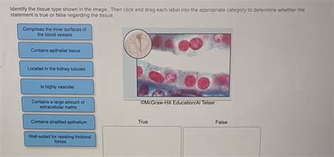 Solved Identify The Tissue Type Shown In The Image Then Click And