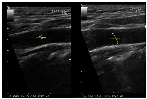 Spectral Doppler Sample Volumegate Length Download Scientific Diagram