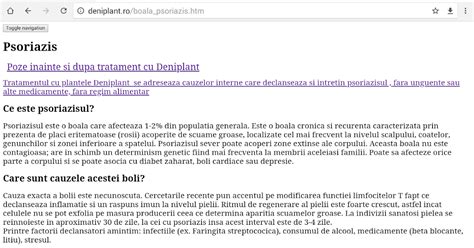 Psoriazis Corespondenta Deniplant Psoriazis Poze Inainte Si Dupa