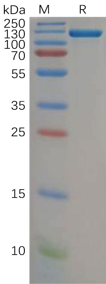 Human CFB Protein hFc Tag 专注肿瘤免疫