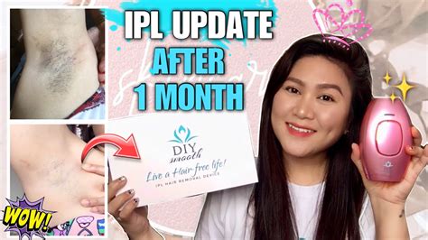 Ipl Permanent Hair Removal Update Part Diy Smooth Ipl Hair Removal