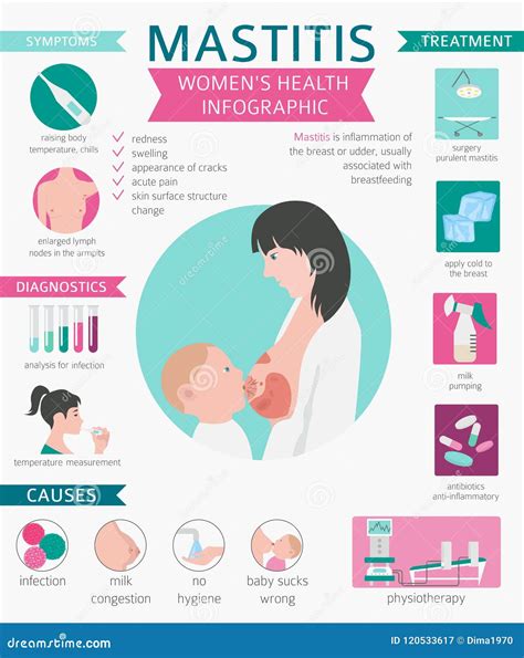 Mastitis Breastfeed Medyczny Infographic Diagnostycy Objawy