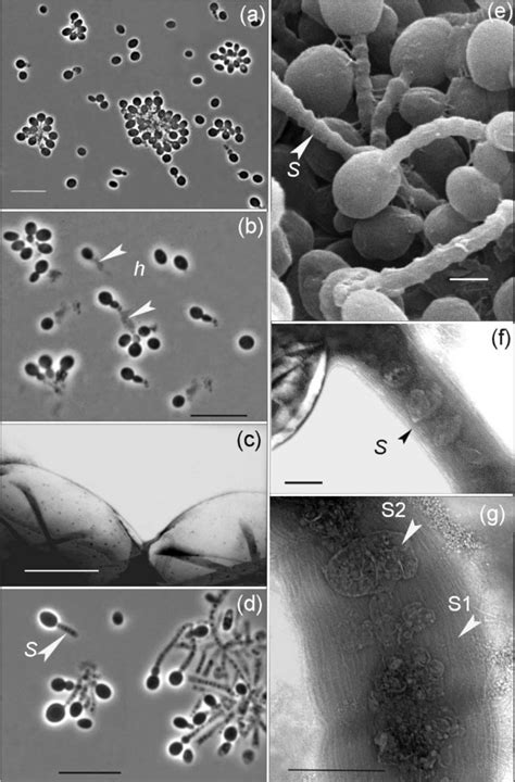 Phase Contrast Micrographs Of Cells Of Strain A10 T Grown For 3 Weeks