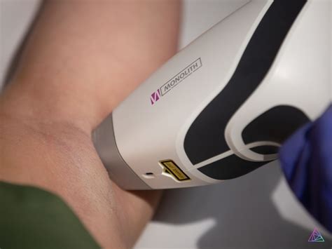 Answering The 5 Most Common Faqs About Laser Hair Removal Astanza