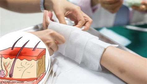 First Aid Treatment For Hot Water Burns Step To Health