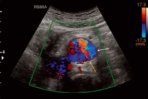 colour doppler dr panchal lab diagnostics centre