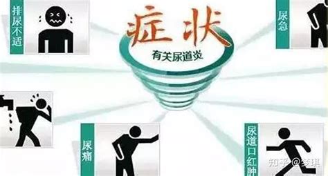 尿道炎会传染吗？ 知乎