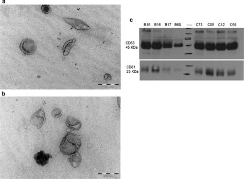 Characterization Of Serum Derived Exosomes A B Transmission Electron