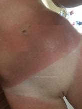 Betty Taube Gunter Nude And Sexual Photos AZNude