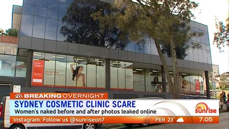 Sydney Cosmetic Clinic Scare Women S Naked Before And After Photos Leaked Online Sun Sunrise