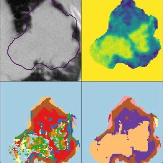 ct image feature map  individualcohort based clustering