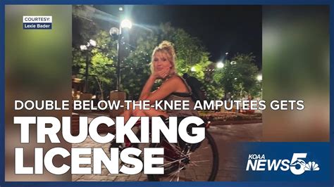 Local Woman Becomes One Of The First Double Below The Knee Amputees To