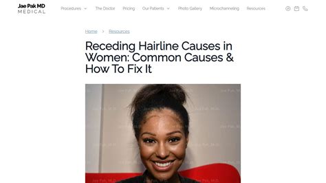 how to fix receeding hairline
