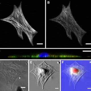 Confocal Microscopy Of Fluorescently Labeled Actin A And Actinin