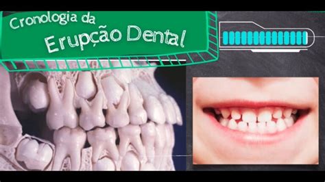 Cronologia dos Dentes Decíduos Um Guia Completo Actualizado enero 2025