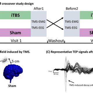 Study Design Tms And Tms Eeg A Patients With Stroke Received Itbs