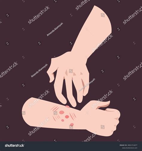13,507 Human Skin Parasites Royalty-Free Images, Stock Photos