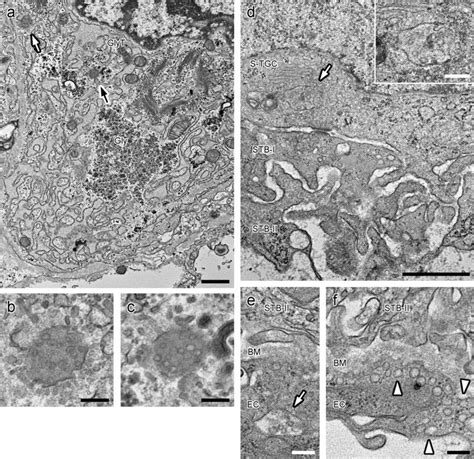 Electron micrographs of the E18.5 placenta. a Glycogen trophoblast cell ...