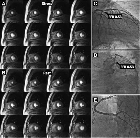 Multicenter Evaluation of Dynamic Three-Dimensional Magnetic Resonance