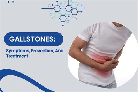 Understanding Gallstones: Symptoms, Prevention, & Treatment