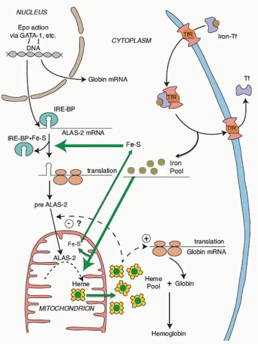 Sideroblastic Anemias Oncohema Key