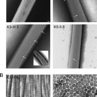 In vitro and dermal collagen fibrils from KS probands. A: Fibrils ...