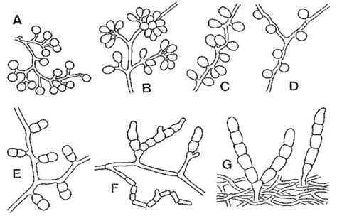 Morphological Identification of Actinobacteria | IntechOpen