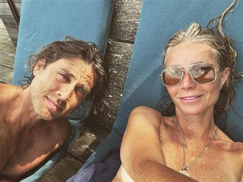 Leni Klum Shows Off Shocking Sunburn In Bikini Photo The Advertiser