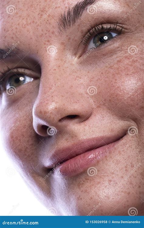 Cute Brunette Woman With Freckles All Over Her Face Clean Flawless Fresh Skin Stock Photo