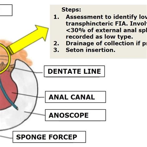Diagramatic representation of m2FiSR, Stage | Download Scientific Diagram