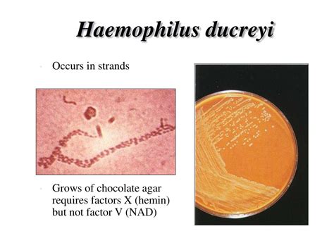 Haemophilus Ducreyi Chocolate Agar