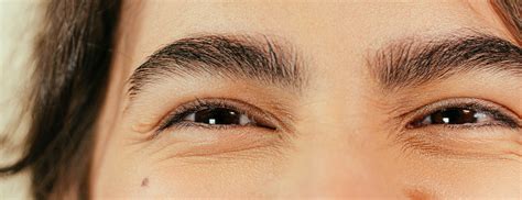 What causes bags under the eyes? | Puffy eyes tips | H&B