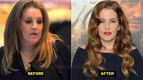 Lisa Marie Presley Weight Gain. Weight Loss, Bariatric Surgery, Death ...