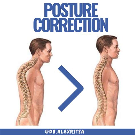 How To Improve My Posture In 4 Simple Steps Posture Correction Toronto Yorkville