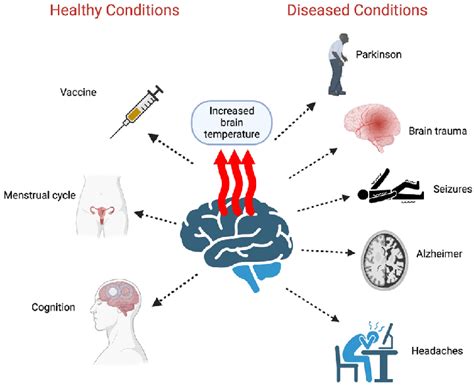 Graphical Abstract 38 Conditions That Increase Brain Temperature