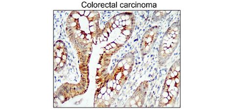 Junctional Protein Antibody Panel Irap Ireal Biotechnology Inc