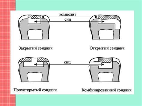 Стеклоиономерные цементы - презентация онлайн