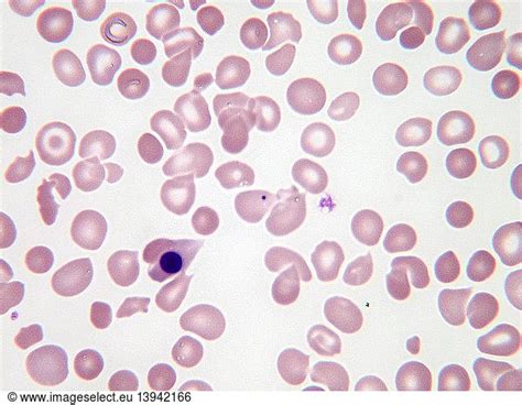 Nucleated Red Blood Cells Nucleated Red Blood Cells Lmbasophilblood
