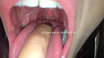 Teeth Videos XVIDEOS
