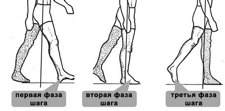 Ночной ортез при пяточной шпоре: что это, применение, эффект