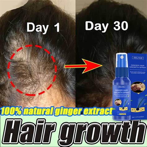 Eelhoe Ginger Hair Growth Spray Hair Growth Serum Ginger Hair Treatment