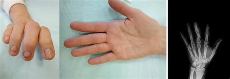 Кисть как идеальный механизм творения. Почему в кистевую хирургию ...