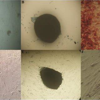 Photomicrograph Of In Vitro Cell Differentiation Of Mscs Derived From