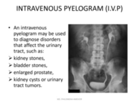 Solution Intravenous Pyelogram I V P 1 1 Studypool