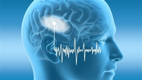 Экспериментальный слуховой имплант успешно регистрирует мозговые волны ...