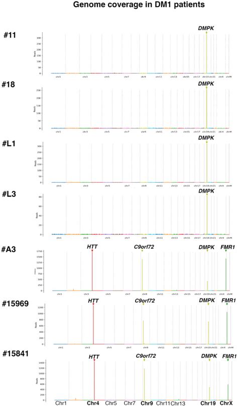 Identification Of A CCG Enriched Expanded Allele In Patients With