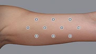 Profhilo-Body - Premium Therapie für erschlaffte Körper-Haut ...