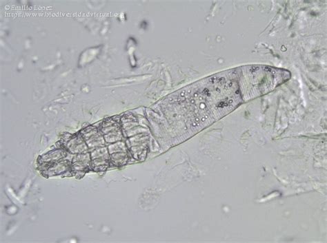 Demodex Canis 473 Biodiversidad Virtual Mundo Microscópico